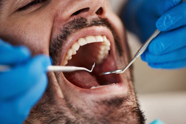Best Emergency Care for Gum Disease in Mount Repose, OH